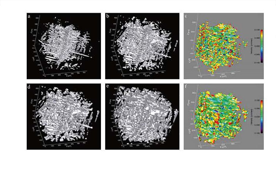 In situ dendrite evolution in an aluminium-copper alloy captured using ultra-fast 3D tomography. Aluminium-rich dendrites are shown in (a, b, d, e). (c) and (f ) show smaller portions of the solid-liquid interface of (a) and (d) coloured according to the velocity of the moving surface with warmer colours, eg red and yellow, indicating faster growth of the dendrites.